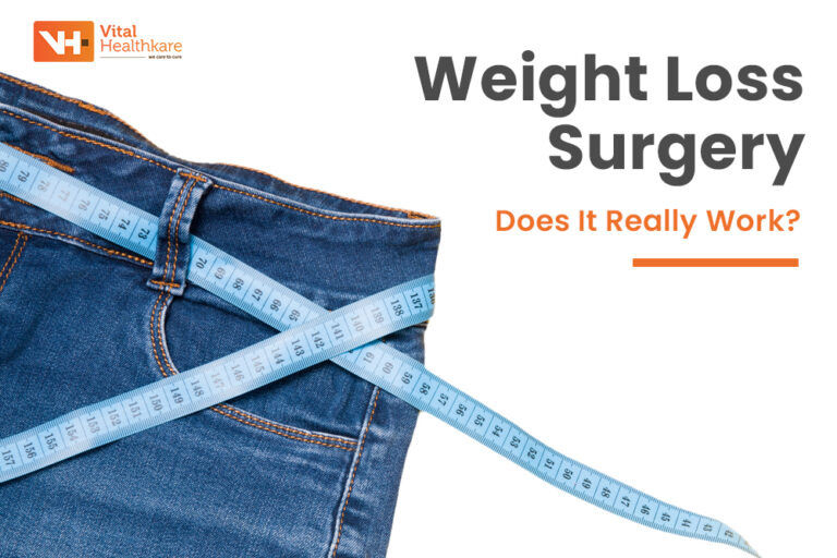 Weight Loss Surgery in India: Types & Benefits
