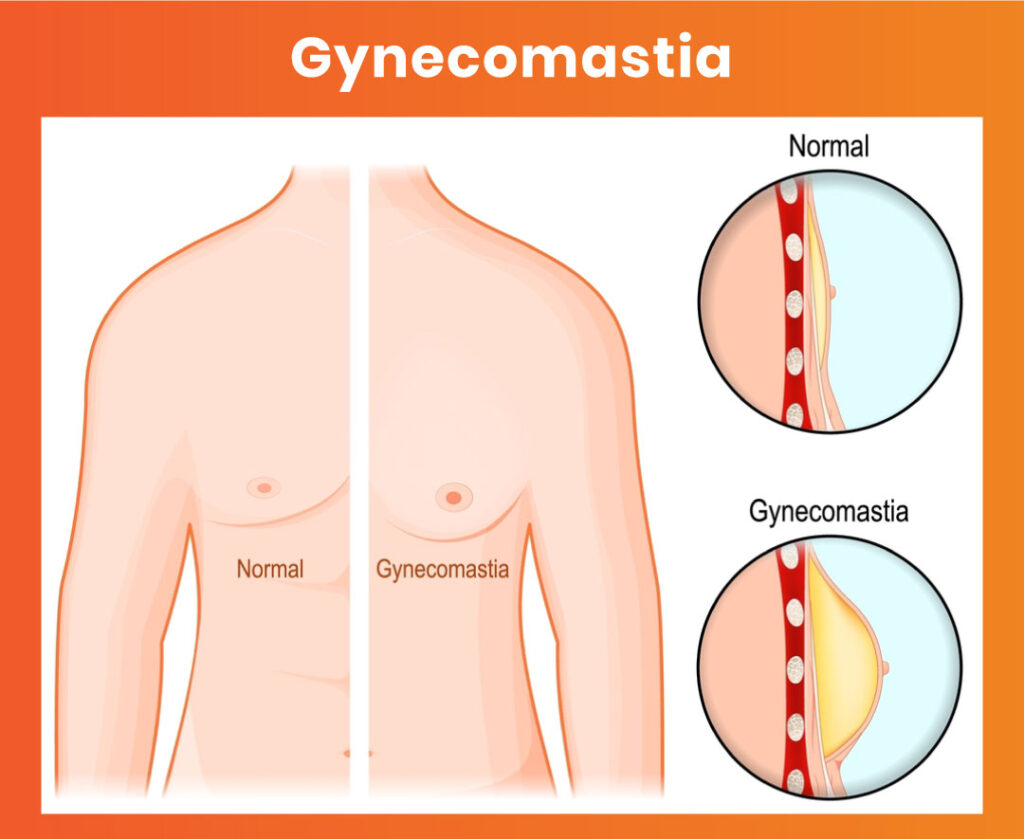 Landing pages banner