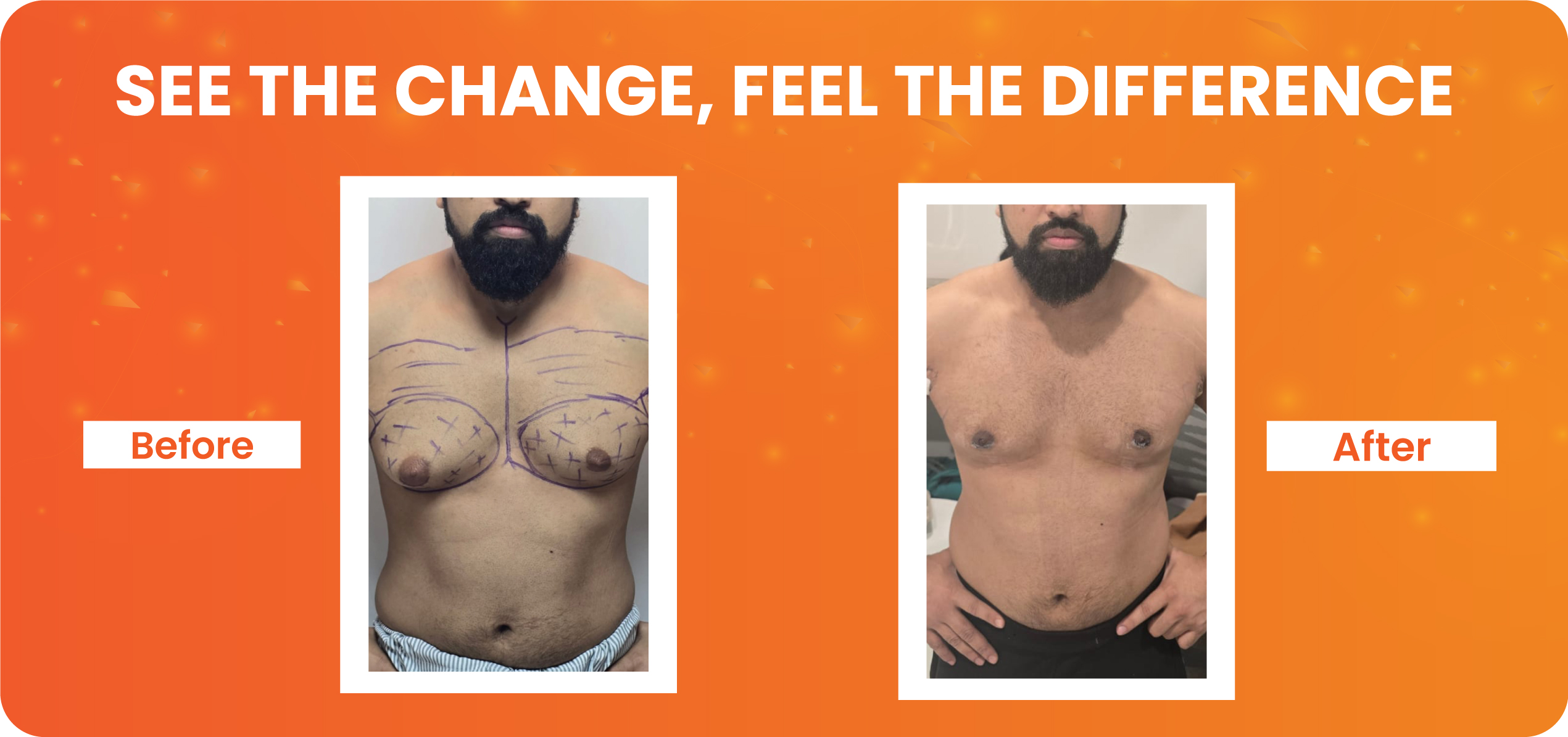 Before-after-post2543